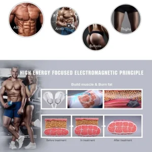 Aparat Sculptor Muscular Tesla EMS Sculpt HI-EMT + RF Remodelare corporala, Creare Masa Musculara, Tonifiere Abdomen, 4 Manipuli, Slabire intensiva NOVA4 - imagine 10