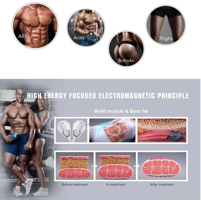 Aparat Sculptor Muscular Tesla EMS Sculpt HI-EMT + RF Remodelare corporala, Creare Masa Musculara, Tonifiere Abdomen, 4 Manipuli, Slabire intensiva NOVA4 - imagine 10