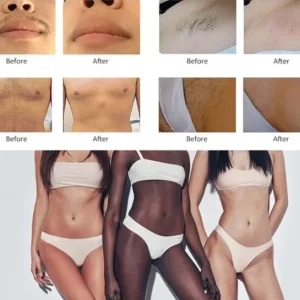 Aparat 1600W Epilare Definitiva Laser Dioda 4 Lungimi 940, 755, 808, 1064nm Profesional 1600W Dioda Laser, 50mil Impulsuri PlatiniuMAX