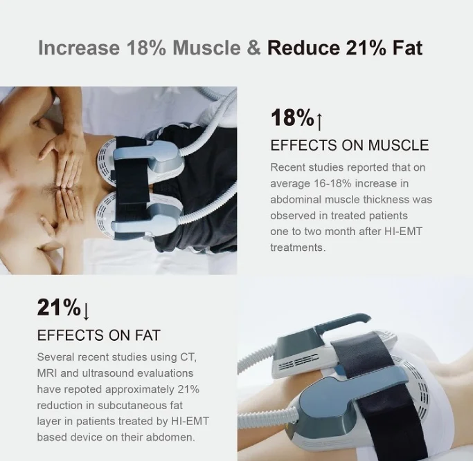 Aparat Sculptor Muscular Tesla EMS Sculpt HI-EMT + RF Remodelare corporala, Creare Masa Musculara, Tonifiere Abdomen, 4 Manipuli, Slabire intensiva NOVA4 - imagine 9