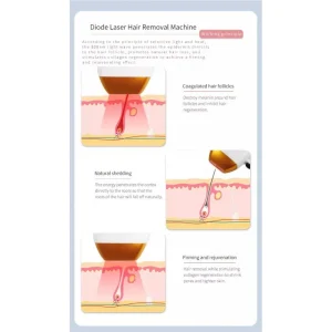 Aparat Epilare Definitiva Laser Dioda 3 lungimi 755NM, 808NM, 1064NM Profesional 1200W Dioda Laser, 50mil Impulsuri DERMASkin Silver